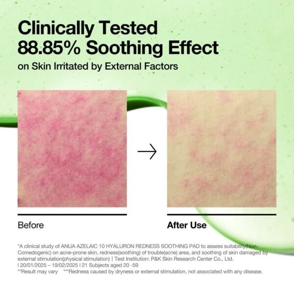 img_7324 Anua Azelaic 10 + Hyaluron Soothing Pad
أنوا وسائد مهدئة بخلاصة حمض الأزيليك والهيالورونيك